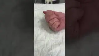 После операции #массаж #доктор #психология #спорт #екатеринбург #science #отношения #дуэт