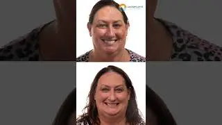Full Mouth Dental Implants Restored Her Smile and Confidence