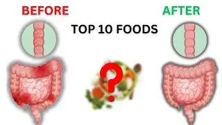 Top 10 Gut-Cleansing Foods You Must Try!