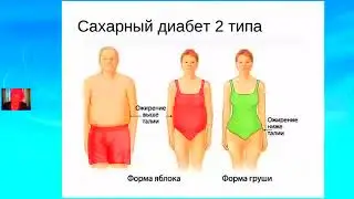Сахарный диабет II типа -  Эндокринолог Л. Засорина.
