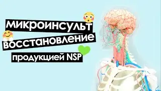 Продукция NSP для реабилитации после инсульта