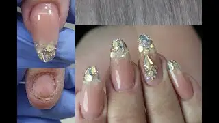 НОГОТЬ был СОРВАН!! Наращивание с аквариумом на поврежденный ноготь