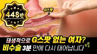 G스팟 없는 여자?! 산부인과에서 만들어드립니다(ft.비수술)
