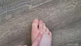 Why are my toes red?
