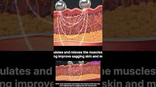 EVE Facial 11: Microcurrent #4