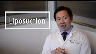 Liposuction Frequently Asked Questions