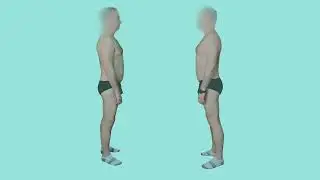 Posture Analysis: Forward Pelvic Tilt