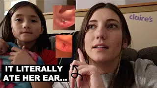 What CLAIRE'S EARRINGS did to my daughter's EAR