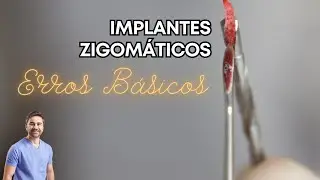 Implantes Zigomáticos - Erros Básicos