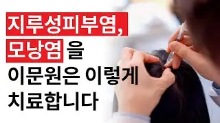 두피 지루성피부염 모낭염 , 이문원 치료법은 이렇습니다