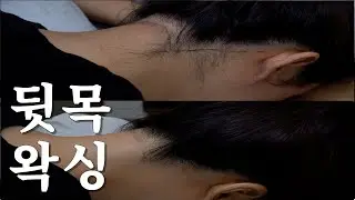여자 뒷목왁싱 시술영상 - 페이스왁싱