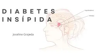 Diabetes insípida | Tipos de diabetes insípida