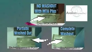 MTA Washout Experiments