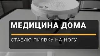Фазенда TV - лечение пиявками - гирудотерапия дома - ставим пиявку сами