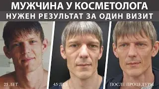 Современные методы против мешков под глазами
