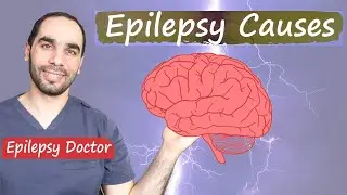 What causes Epilepsy and Seizures? Depends on the age