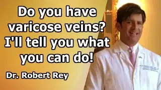 Dr. Rey - Do you have varicose veins? I'll tell you what to do!