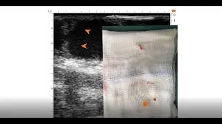 Medistim at ESVS 2021