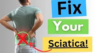 How To FIX SCIATICA Without Seeing a Doctor!