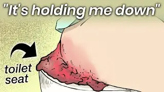 The Woman Who Was Stuck to a Toilet Seat for 2 Years