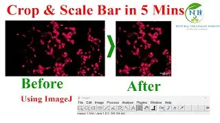 How to Crop an Image and Add a Scale Bar Using ImageJ Software (Step-by-Step Guide)