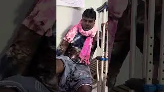 Failed fracture operation,Compression External Fixation,Infected Tibia Fracture.