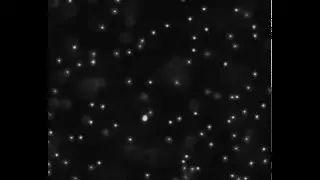One Micron Latex Balls Through Microscope