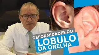 Cirurgia Plástica para Orelhas Deformadas . Dr Lecy Marcondes explica