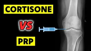 PRP vs Cortisone Shots: A Doctor Breaks Down the BEST Option for You!