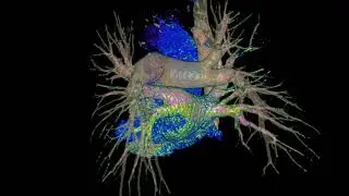 ct pulmonary angiography CTPA