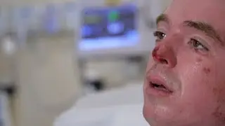 Wildfire survivor speaks from his hospital bed | UW Medicine