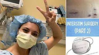 My Experience with the Interstim Surgery (part 2): I GOT THE PERMANENT DEVICE!!
