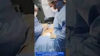 Implante de neuroestimulador medular em coluna