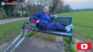 Amputee woman crutches user: walking freely after amputation