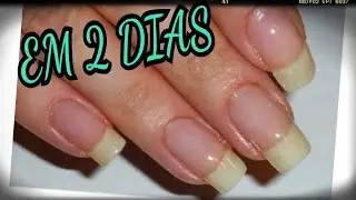 UNHAS GRANDES EM 2 DIAS #COMPROVADO