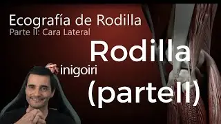 ECOGRAFÍA DE LA RODILLA (PARTE II): CARA LATERAL