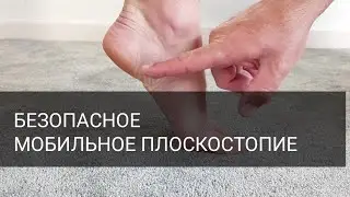 Мобильное плоскостопие. Диагностика стопы. 
