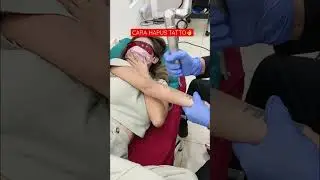 The Most Effective Way to Remove Tattoos in 2022 
