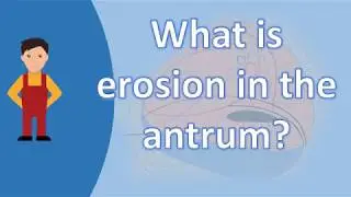 What is erosion in the antrum ? | Best and Top Health FAQs
