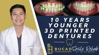 10 Years Younger Using 3D Printed Dentures