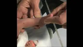 Parent guide to club foot stretches: Step 1