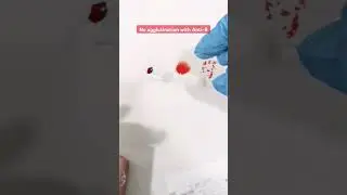 "A" positive blood type sample