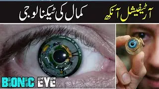 what is bionic eye Explain in Urdu | Bionic Vision | itechstudy