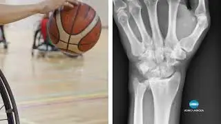 Explore Wrist Motion in Sports with Dynamic Digital Radiography (DDR) | Konica Minolta Healthcare