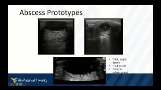 POCUS in Skin and Soft Tissue Infections 1 - Intro and Key Findings