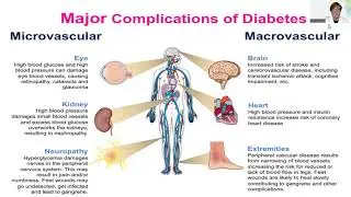 DIABETES Dr  Kimberly Langdon