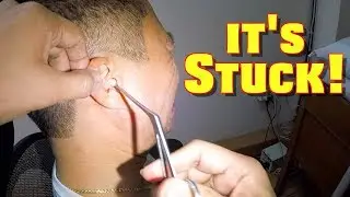 Removing Cotton Stuck In Man's Ears- Look! Who Gets The Last Laugh?