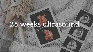 28 weeks ultrasound scan