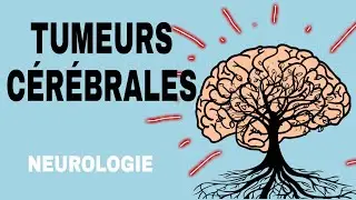 NEUROLOGIE : TUMEURS CÉRÉBRALES 🌟