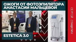 Ожоги от фотоэпилятора Анастасии Мальцевой на Estetica 3.0 | Разбор случая